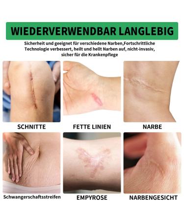 Silicone Scar Sheets - Professional Silicone Paving for Scars 4cm x 150cm Roll Ideal for C-section Burns Keloid & Acne - Medication-Free Solution - Buy Online on GoSupps.com