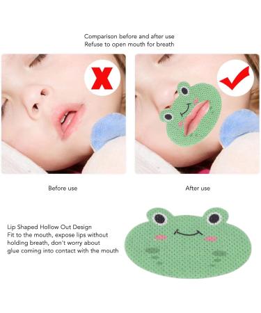 Kids Sleep Strips Central Opening Improve Sleeping Kids Mouth Strip Tape 30Pcs for Night - Buy Online on GoSupps.com