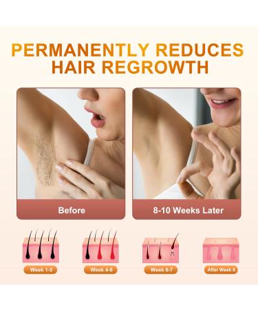 Laser Hair Removal Device for Women - Permanent IPL at-home Hair Removal with 999900 Flashes - Suitable for Facial, Legs, Arms, and Whole Body (Black) - Buy Online on GoSupps.com