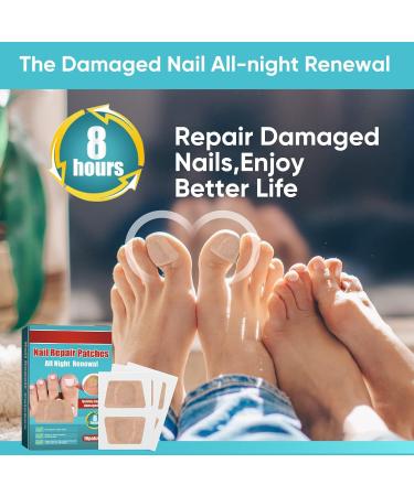 Nighttime Renewal Toe Nail Patches for Fungus - Fast & Effective Foot Care (16 Patches) - Buy Online on GoSupps.com