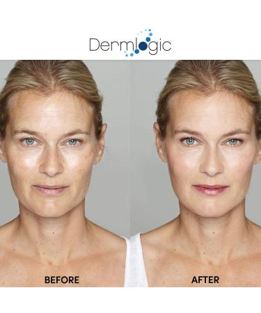 Anti-Aging Resurfacing Peel Pads with Salicylic, Glycolic, and Lactic Acid - Hyaluronic, Witch Hazel, Green Tea, and Aloe Vera - Exfoliates for Dark Spots & Scars - Buy Online on GoSupps.com
