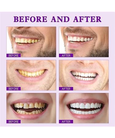 SP-7 Probiotic Whitening Toothpaste - Brightening & Stain Removing for All Teeth Types Deep Cleaning Gums 1PC - Buy Online on GoSupps.com