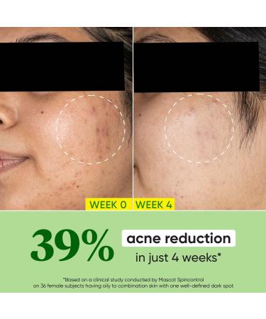 Dot & Key Cica Calming Skin Renewing Night Gel 60ml | Soothing Gel for Oily & Acne-Prone Skin Reduces Redness Balances Oil & Promotes Clearer Complexion - Buy Online on GoSupps.com