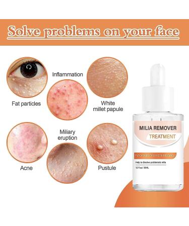 4Pcs Milia Clearing Essence Milia Remover Eye Serum Milia Remover Milia Spot Miliary Repair Essence Moisturize Skin Improve Skin Texture for All Skin Types 30ml/1fl.oz - Buy Online on GoSupps.com