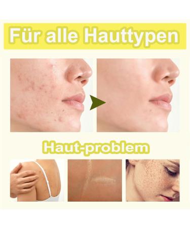  MEITREND Tourmeric Kojic Acid Lemon Turmeric Soap for Removing Dark Spots from Face and Body Turmeric and Kojic Acid Soap Lemon Shine Soap - Cleanser - 2 Pack - Buy Online on GoSupps.com