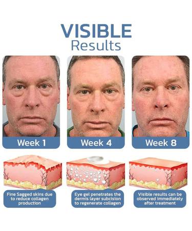 OPENEYES Peptide Lifting Eye Gel - Reduce Puffiness, Dark Circles & Wrinkles (3 Pack) - Buy Online on GoSupps.com