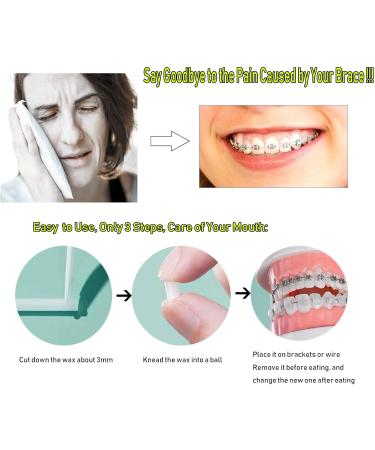 Orthodontic Wax for Braces - Pain Relief 20 Pieces 10 Color Options | Dental Wax for Irritation - Buy Online on GoSupps.com