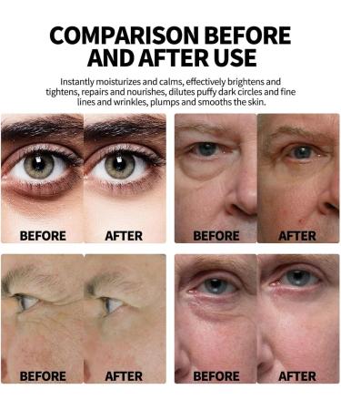  SRBIRD Anti Wrinkle Eye Roller for Men - Cooling Eye Stick for Puffiness & Dark Circles Peptides & Vitamin C Moisturizing Firming for All Skin Types (10ml 2) - Buy Online on GoSupps.com