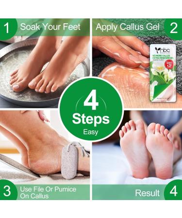 Jasmine Callus Remover Gel 8.4 oz with Pumice Stone Scrubber Kit - Professional Pedicure, Remove Hard Skin, Heels Calluses - 12 Pack - Buy Online on GoSupps.com