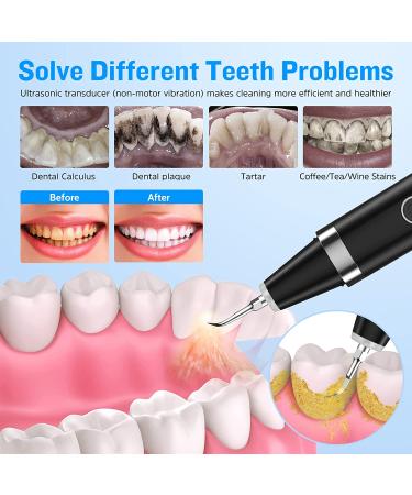 Ultrasonic Plaque Remover & Dental Cleaner Kit | 5 Modes for Calculus & Stain Removal | Electric Tooth Cleaning Tools with 2 Heads & Mirror - Black - Buy Online on GoSupps.com