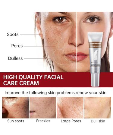 Dark Spot Remover Hyperpigmentation Treatment Dark Spot Corrector for Face Freckle Remover Cream Age Spots & Sunspots & Melasma Cream Even Skin Tone Moisturizing Erase Fine Lines Firming - Buy Online on GoSupps.com
