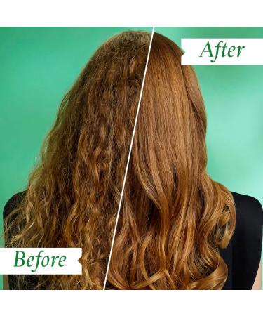 Philip Kingsley Flaky/Itchy Scalp Toner 250ml - Soothing Scalp Care for Dry & Oily Scalps - Buy Online on GoSupps.com