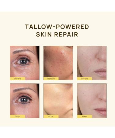 Elrisme Grass-Fed Beef Tallow for Skin: Organic Whipped Tallow and Honey Balm - Face Moisturizer & Body Cream - Deep Hydrating & Nourishing - Raw Wild Honey Beeswax & Vitamin E 2.3 Oz - Buy Online on GoSupps.com