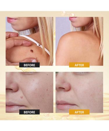 Bee Venom Comprehensive Cream Professional Bee Venom Skin Treatment Cream Firming & Wrinkle-Reducing Deeply Nourishes The Skin Natural Face Moisturizers Suitable for All Skin Types - Buy Online on GoSupps.com