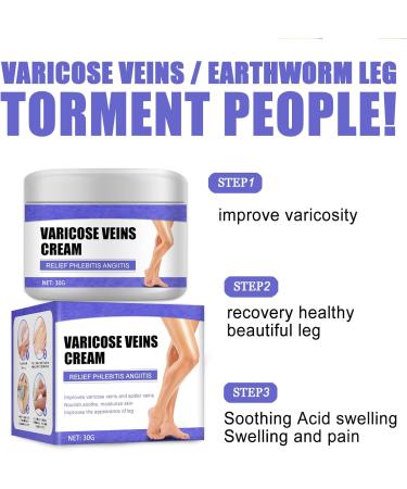 Varicose Veins Cream - Herbal Ointment for Leg Fatigue - Improve Circulation and Eliminate Spider Veins (30g) - Buy Online on GoSupps.com