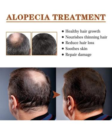 Eventerde Natural Hair Growth Oil 50ml Strengthening Natural Hair Conditioner Beauty Products for Scalp Texture Improvement Daily Style and Special Occasions - Buy Online on GoSupps.com