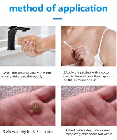 Cr me anti-verrues 20 g - Buy Online on GoSupps.com