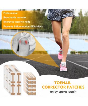 Xinzan 2 Types Ingrown Toenail Treatment Patch with Ingrown Toenail Tool Professional Ingrown Toenail Corrector Tools for Toenail Care Protect Toe Nail - Buy Online on GoSupps.com