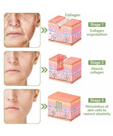 Bee Venom Multi-Purpose Skin Treatment Cream Powerful All-Body skin Cream Intensive skin care and wrinkle reduction (1PC) - Buy Online on GoSupps.com