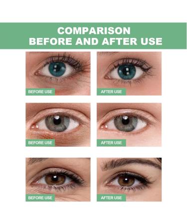 Aloe Vera Eye Patches - Under Eye Patches - Eye Masks for Puffy Eyes - Under Eye Masks - Eye Patches Skincare - Eye Bags Remover and Anti Wrinkle - Eye Care for Woman and Man - 20 Pairs - Buy Online on GoSupps.com