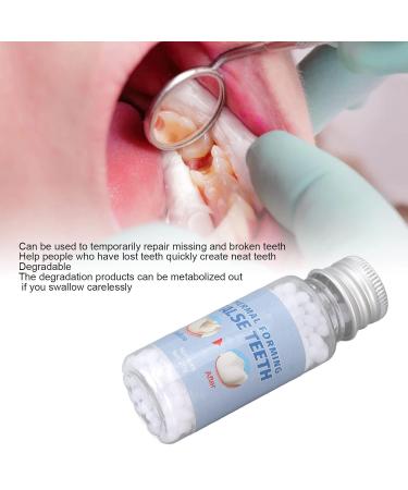 Tooth Repair Kit - Temporary Thermal Filling Beads for Broken & Missing Teeth - 20g White | Fast International Shipping - Buy Online on GoSupps.com