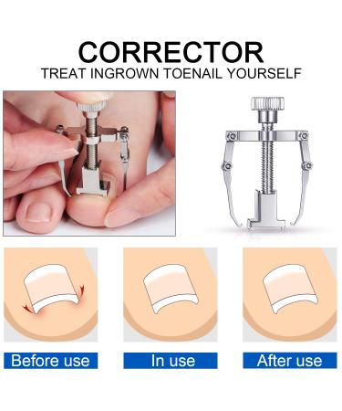 10-Piece Ingrown Toenail Tool Set for Nail Care and Removal - Manicure Pedicure Clippers Kit - Buy Online on GoSupps.com