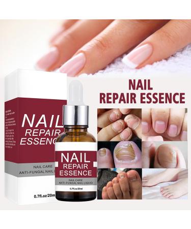 Extra Strong Fungal Nail Treatment - Nail Fungus Remover Kit with File and Brush - 20ml - Buy Online on GoSupps.com