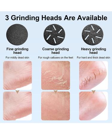 Rechargeable Electric Foot Callus Remover with Vacuum - Professional Pedicure Kit for Smooth Skin - 2 Speeds & LCD Display - White - Buy Online on GoSupps.com