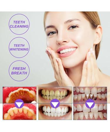 2 PCs Smile Doctor SP-4 Probiotic Whitening Toothpaste | 2024 Ultra Brightening & Fresh Breath Stain Removal - Buy Online on GoSupps.com