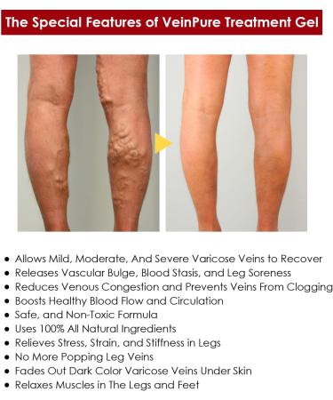 Varicose Veins Gel Veinhealing varicose veins gel refreshment and relaxation of swollen and tired legs Legs Care Cream - Buy Online on GoSupps.com