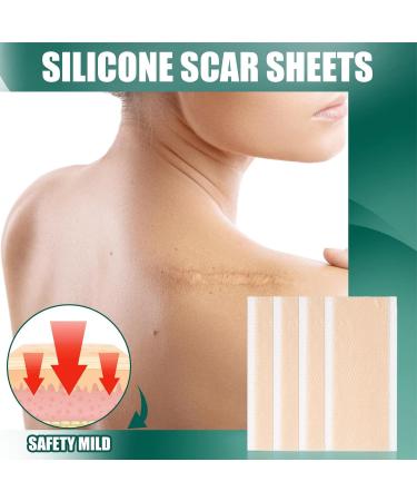 Milageto Plaster for Skin Scars - Reusable & Effective Treatment 15x4cm | International Shipping Available - Buy Online on GoSupps.com