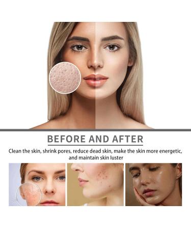 Retinol Moisturizer Anti Aging Cream Face Moisturiser with Hyaluronic Acid for Women Men Anti Wrinkle Face Cream with 2.5% Retinol Cream Face Cream Reduce Fine Lines Deep Hydration Cream 50g - Buy Online on GoSupps.com