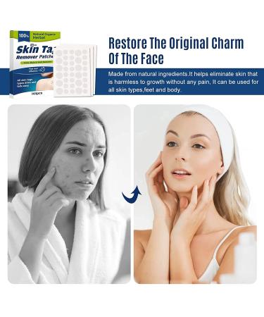 Skin Tag Remover Patch 144 PCS | Safe & Effective Skin Tag Removal Patches | 144 pcs/box - Buy Online on GoSupps.com