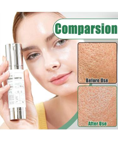 ARHZ 1 piece microneedling serum for pore care and peeling exosome Centella Asiatica for glass skin skin structure 50 ml - Buy Online on GoSupps.com