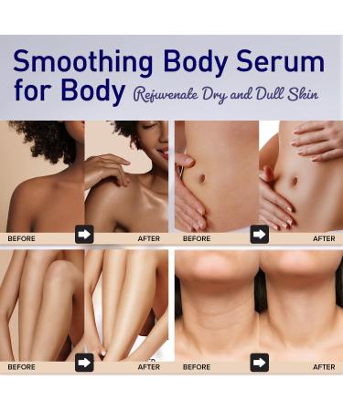 Women s Smoothing Body Serum | Anti-Wrinkle Moisturizer with Niacinamide & Hyaluronic Acid | Revitalizes Dry Skin for All Skin Types - Buy Online on GoSupps.com