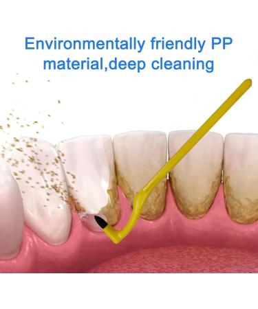 4-Piece Tartar Remover Set | DIY Teeth Stain & Plaque Removal | Dental Tray for Discoloration - Buy Online on GoSupps.com