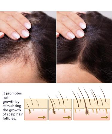 Hair Boost Strengthening Spray - Buy Online on GoSupps.com