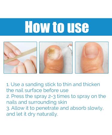 DFVGC Foot care spray supports an improved foot climate foot spray foot treatment cares for skin and nails athletes foot treatment protective spray for nail and foot care 2 pieces one 2 pieces 50 ml 2er Pack - Buy Online on GoSupps.com