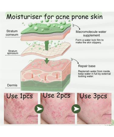 Acne Cream Moisturiser Face Cream Spot Cream Mens Moisturiser Tea Tree Cream Spot Cream For Acne Cream Moisturiser for Women Men Teenagers Dilute Face Prone Spot Marks Balance Facial Oil Cream - Buy Online on GoSupps.com