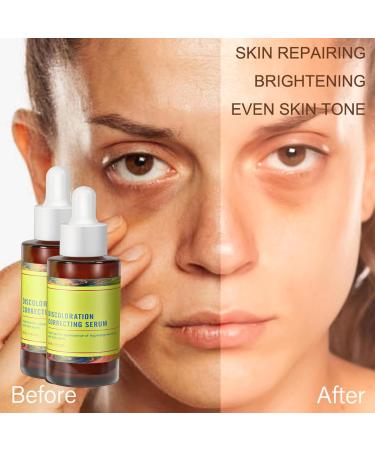 Dark Spot Remover Serum for Face & Body | Age Spot Sun Spot Freckles Brown Spot Corrector for Men & Women - 30ml - Buy Online on GoSupps.com