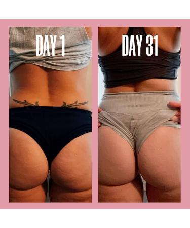 MALYS B-TIGHT Lift and Firm Booty Mask - Cellulite Reduction with Hyaluronic Acid, Guarana Extract, Pink Pepperslim - Buy Online on GoSupps.com