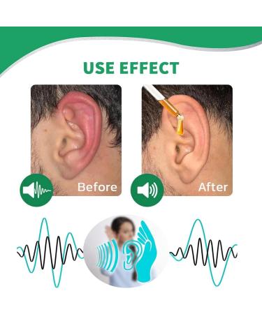 Tinnitus Relief Ear Drops - Pain Relief, Earache Relief, Treatment for Ringing Ears - Buy Online on GoSupps.com