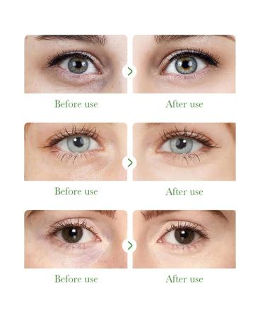 Aloe Vera Under Eye Mask - 60 PCS Collagen & Hyaluronic Acid Patches for Dark Circles Puffiness & Wrinkles Revitalize & Firm Eye Skin Care - Buy Online on GoSupps.com