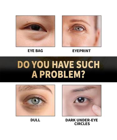 Retinol Eye Serum for Dark Circles & Puffy Eyes - Anti-Aging Cream to Reduce Wrinkles & Hydrate Skin - Suitable for All Skin Types - Buy Online on GoSupps.com