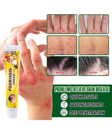 MagiSel Anti-itch ointment soothing skin cream for itching and psoriasis natural care formula skin cream cares for and soothes the skin non-irritating (20 g) - Buy Online on GoSupps.com