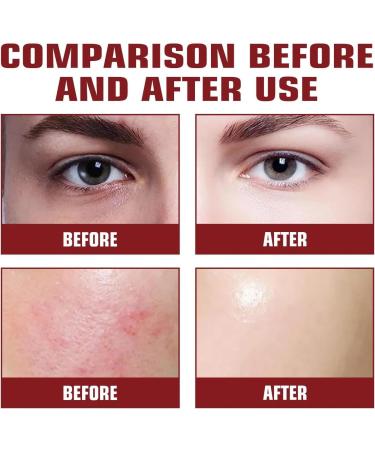 Face Moisturiser - Soothing & Barrier Support Serum 1 oz / 30 ml - Relieves Dry/Tight/Reddened Skin - Buy Online on GoSupps.com