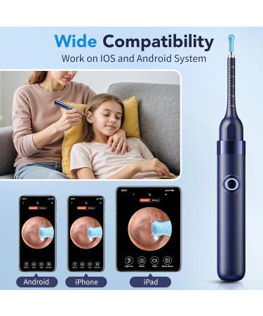 Ear Wax Removal Ear Cleaner with Camera 1296P HD Visual Ear Cleaner with 6 LED Lights and Flexible Tip FSA HSA Eligible Items Safe Ear Wax Removal Kit with Camera Ear Cleaning Tool for Family Gifts Black - Buy Online on GoSupps.com