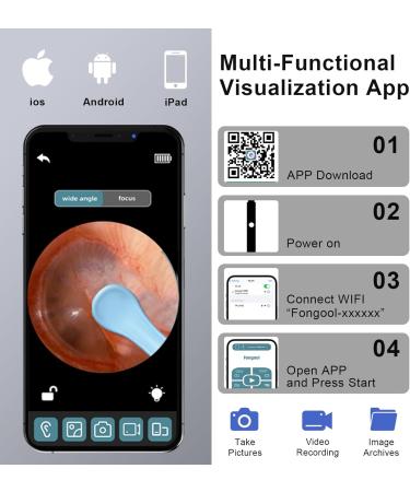 Uthvouxy Ear Wax Removal Kit - 1296P HD Camera 6 LED Lights 10 Ear Picks & Folding Spoon - Safe & Easy Ear Cleaner for iOS & Android - Buy Online on GoSupps.com