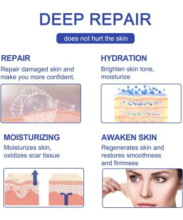 Yissone 1.6x120 Reusable Silicone Scar Sheets - for Softening and Flattening Scars - Silicone Scar Tape Roll - Buy Online on GoSupps.com