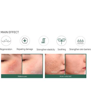 SOME BY MI AHA-BHA-PHA 30 DAYS MIRACLE CREAM 60g - Buy Online on GoSupps.com